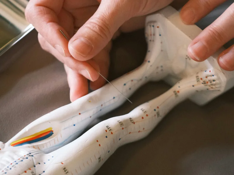 Acupuncture at Live Well Family Chiropractic in Houston