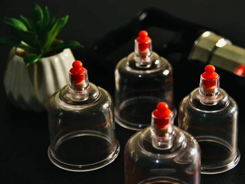 How Cupping Therapy works at Live Well Family Chiropractic