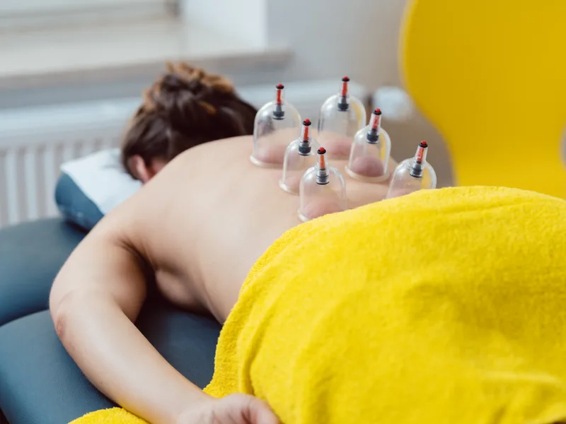 Cupping Therapy at Live Well Family Chiropractic in Houston