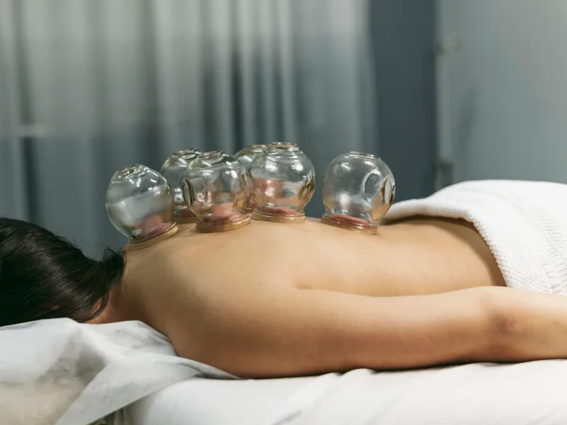 Cupping Therapy at Live Well Family Chiropractic in Houston