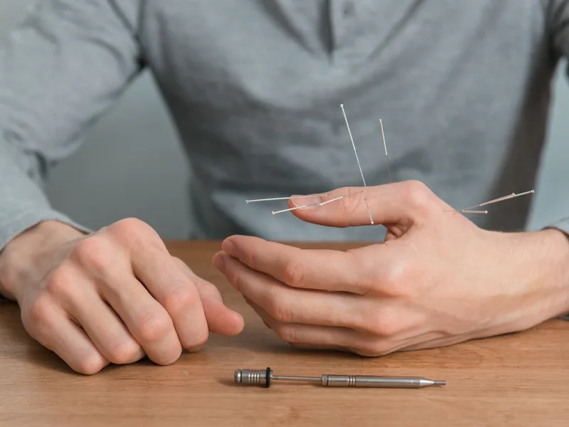 Dry Needling at Live Well Family Chiropractic in Houston