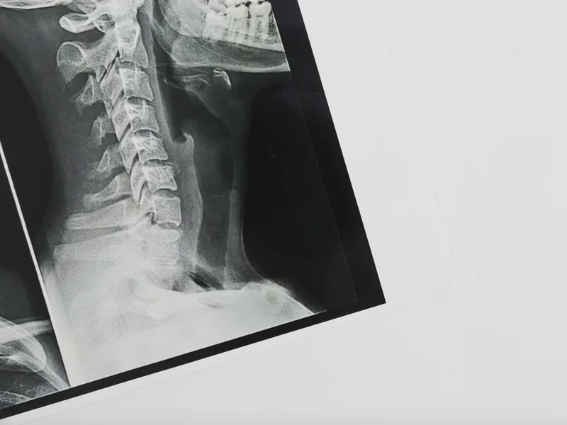 X-Rays at Live Well Family Chiropractic in Houston